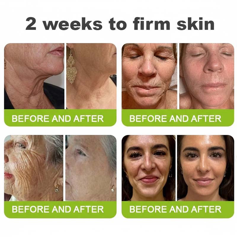 Final 3 Hours: 70%OFF🔥 Botulinum & Vita-A Retinol Shot Wrinkle-Lift Tightening cream✨