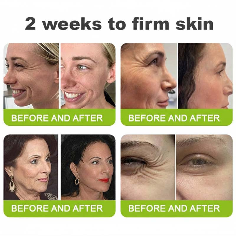 Final 3 Hours: 70%OFF🔥 Botulinum & Vita-A Retinol Shot Wrinkle-Lift Tightening cream✨