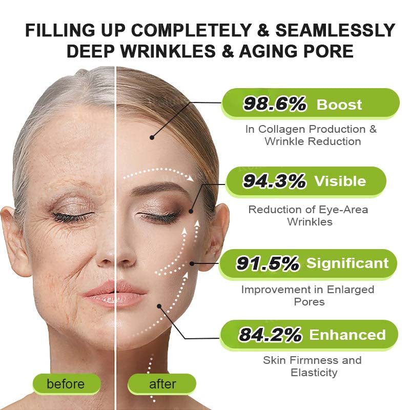 Final 3 Hours: 70%OFF🔥 Botulinum & Vita-A Retinol Shot Wrinkle-Lift Tightening cream✨