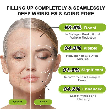 Final 3 Hours: 70%OFF🔥 Botulinum & Vita-A Retinol Shot Wrinkle-Lift Tightening cream✨