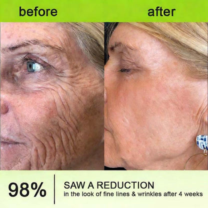 Final 3 Hours: 70%OFF🔥 Botulinum & Vita-A Retinol Shot Wrinkle-Lift Tightening cream✨